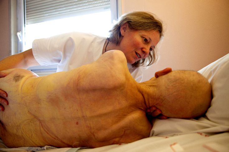 🌱 ผ้าอ้อมผู้ใหญ่ ทางเลือกที่ช่วยเสริมคุณภาพชีวิตผู้สูงอายุและผู้ป่วยติดเตียง